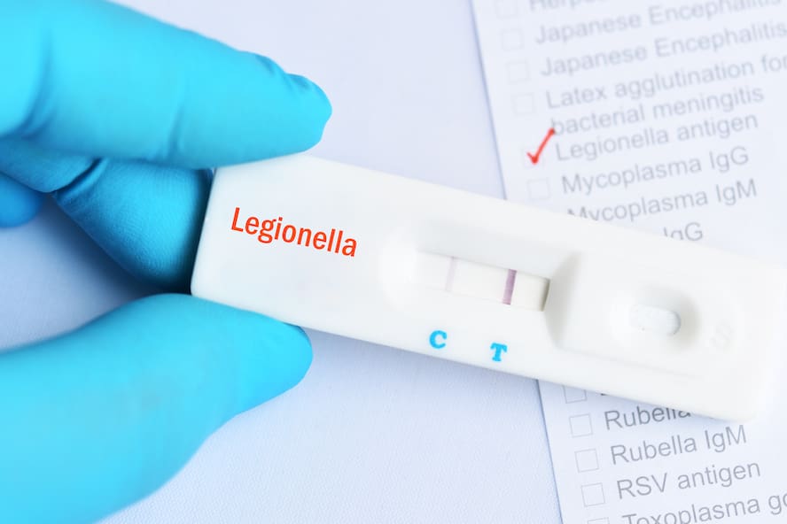 Legionella positive test result by using rapid test cassette